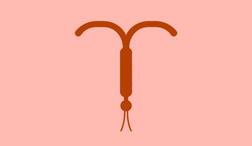 Dispositif intra-utérin (stérilet)