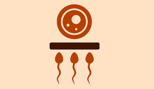 Contraception barrière