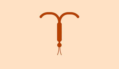 Dispositif intra-utérin (stérilet)