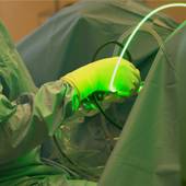 20250717_DM-Lasers-Urologie