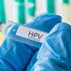Point de situation sur la surveillance des vaccins HPV